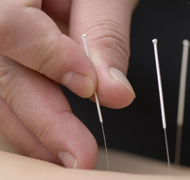 Eczeem – Acupuncturisten Overzicht